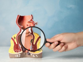 Fistula Treatment
